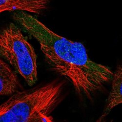 LIS1 Antibody, Novus Biologicals 0.1mL; Unlabeled:Antibodies, Polyclonal